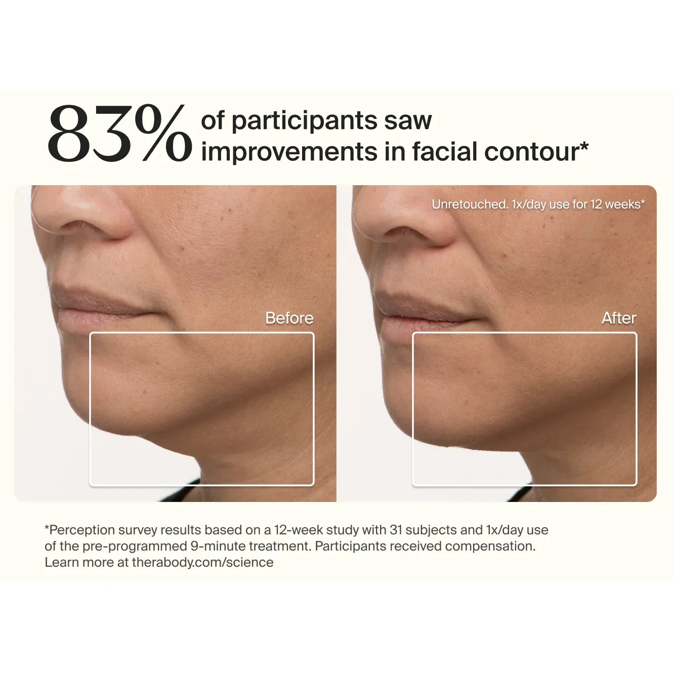 TheraFace Mask — premium full-face LED light therapy mask by Therabody — product view 3