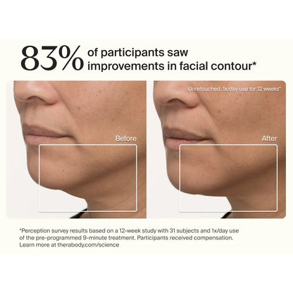 TheraFace Mask — premium full-face LED light therapy mask by Therabody — product view 3